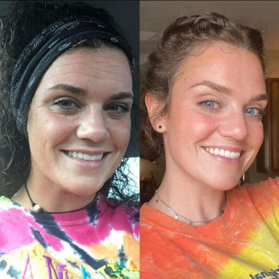 Losveo™ - Silicone Scar Sheets