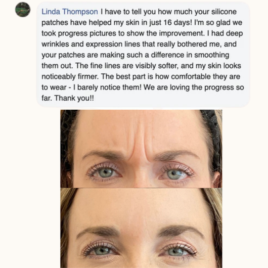 Losveo™ Forehead & 11 Lines Smoother