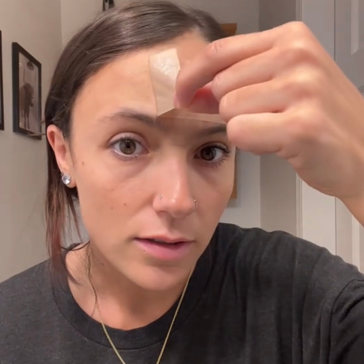 Second Skin™ – Forehead & 11 Lines Smoother